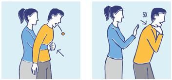 Perform abdominal thrust, repeat until object is expelled