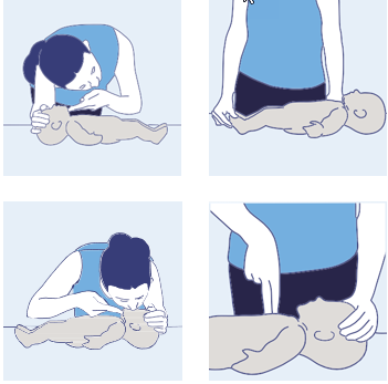 Standard CPR for infants less than age 1